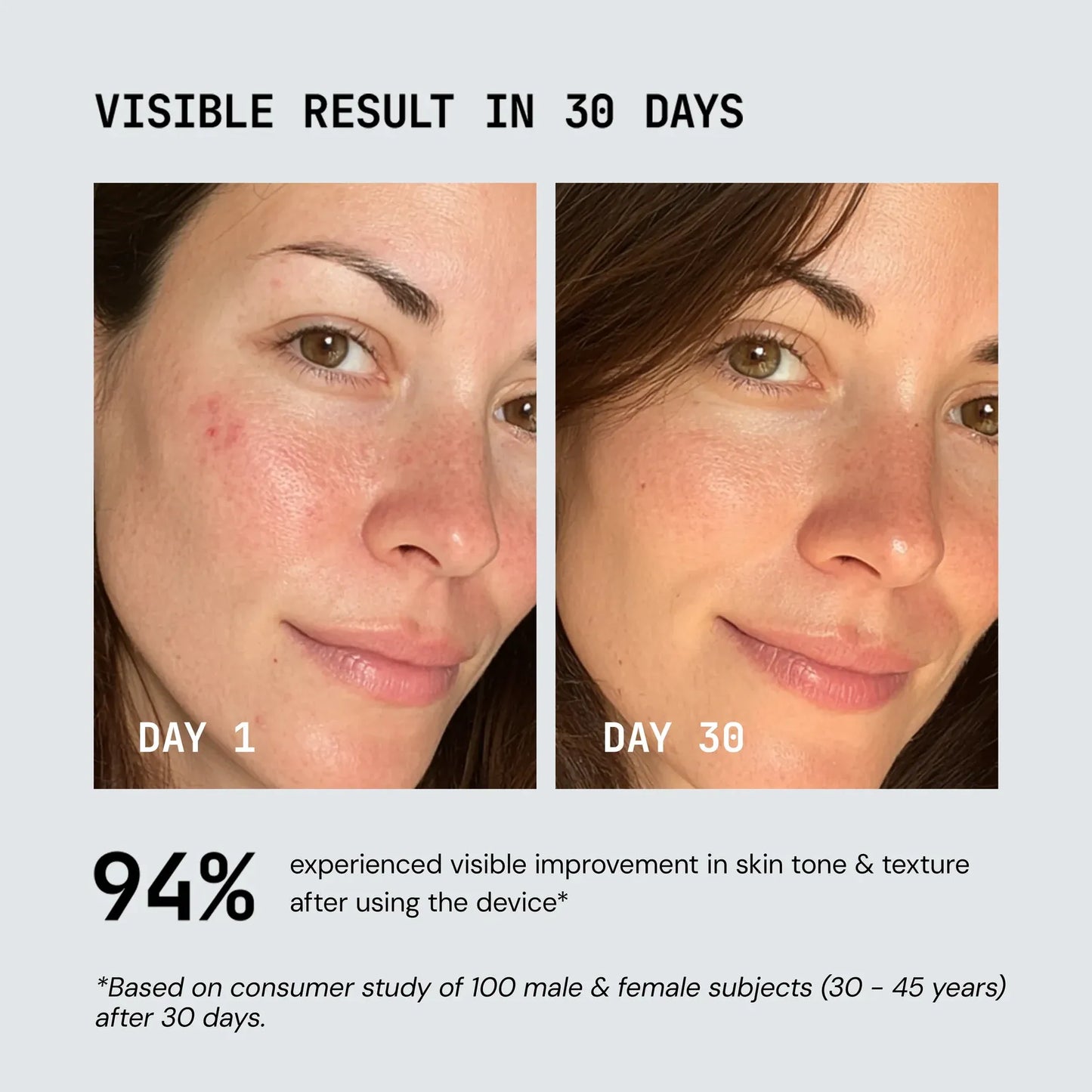 Lume Red Light Therapy