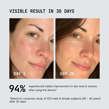 Lume Red Light Therapy